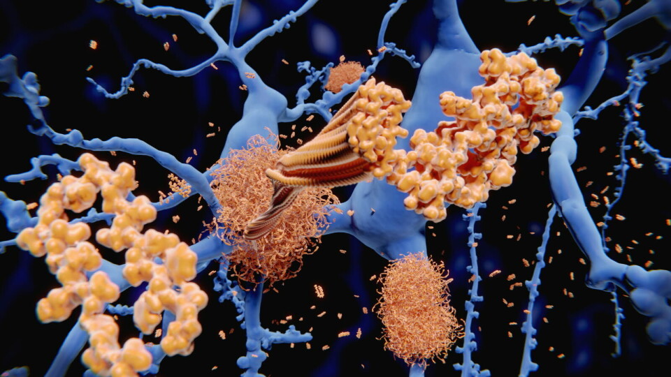 JUKS? I den 16 år gamle Nature-studien pekte forskerne på en undertype av amyloid beta som kunne knyttes til utviklingen av demensrelaterte hukommelsesproblemer hos rotter. Illustrasjon: Getty Images Foto: JUKS? I den 16 år gamle Nature-studien pekte forskerne på en undertype av amyloid beta som kunne knyttes til utviklingen av demensrelaterte hukommelsesproblemer hos rotter. Illustrasjon: Getty Images Foto: