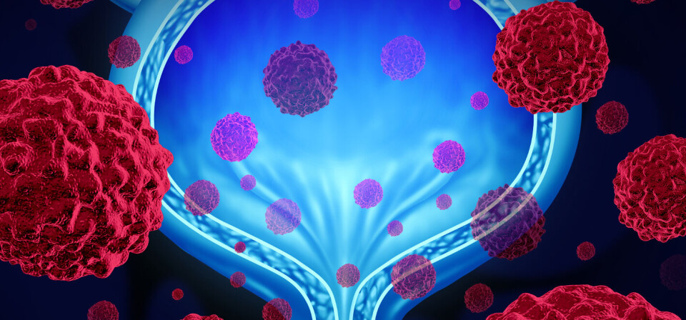 Foto: iStock/Getty Images Foto: iStock/Getty Images