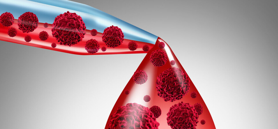Foto: Thinkstock