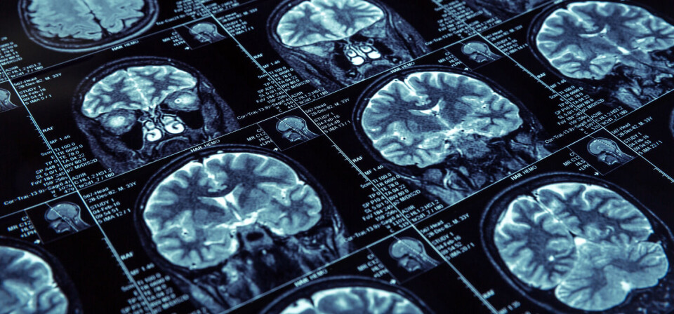 Foto: Thinkstock