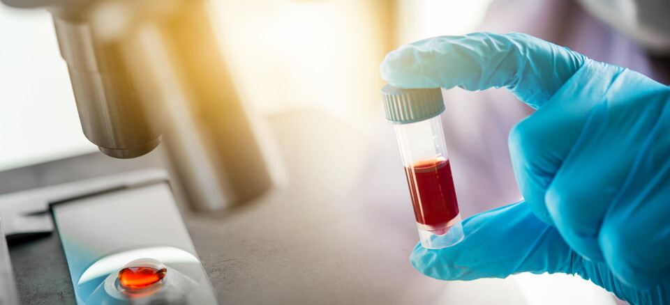 STORE AVTALER: Synsyne Health har nå inngått samarbeider med både Roche, Bayer, Alexion og BMS. Illustrasjon: Getty Images Foto: