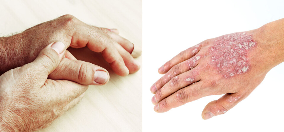 Foto: iStock/Getty Images