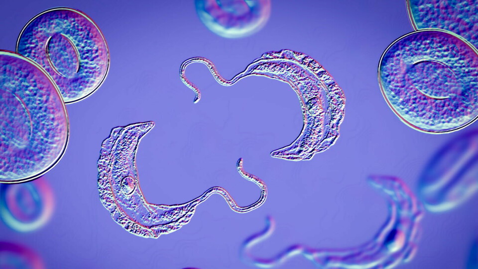KAN REVOLUSJONERE BEHANDLINGEN: Bildet viser trypanosoma brucei-parasitten, som forårsaker afrikanske sovesyke. Nå kan Sanofi melde om svært positive resultater fra en studie på en mulig behandling av sykdommen. Illustrasjonsbildet: Getty Images Foto: