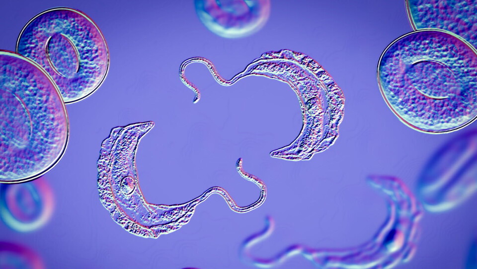 KAN REVOLUSJONERE BEHANDLINGEN: Bildet viser trypanosoma brucei-parasitten, som forårsaker afrikanske sovesyke. Nå kan Sanofi melde om svært positive resultater fra en studie på en mulig behandling av sykdommen. Illustrasjonsbildet: Getty Images Foto: KAN REVOLUSJONERE BEHANDLINGEN: Bildet viser trypanosoma brucei-parasitten, som forårsaker afrikanske sovesyke. Nå kan Sanofi melde om svært positive resultater fra en studie på en mulig behandling av sykdommen. Illustrasjonsbildet: Getty Images Foto:
