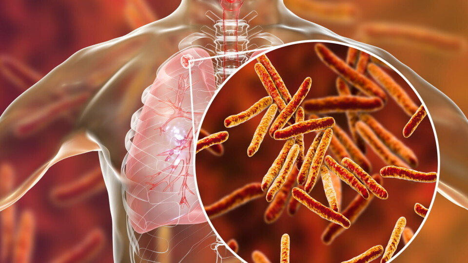 KAN ENDRE LANDSKAPET: – Eksisterende behandlinger for tuberkulose kan være kompliserte, langvarige og ha alvorlige bivirkninger, som signifikant kan påvirke livene til tuberkulose-pasienter globalt. Dagens oppløftende data gir oss et godt fundament som gjør at vi kan evaluere GSK3036656 i forskjellige kombinasjoner i fase 2B/C-studier, sier David Barros-Aguirre, Head of Global Health Medicines R&D i GSK. Illustrasjonsbilde: Getty Images Foto: KAN ENDRE LANDSKAPET: – Eksisterende behandlinger for tuberkulose kan være kompliserte, langvarige og ha alvorlige bivirkninger, som signifikant kan påvirke livene til tuberkulose-pasienter globalt. Dagens oppløftende data gir oss et godt fundament som gjør at vi kan evaluere GSK3036656 i forskjellige kombinasjoner i fase 2B/C-studier, sier David Barros-Aguirre, Head of Global Health Medicines R&D i GSK. Illustrasjonsbilde: Getty Images Foto: