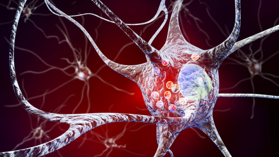 FEILET: To legemiddelstudier viser manglende effekt av behandling mot mulig årsak til Parkinsons sykdom. Illustrasjonsbilde: Getty Images Foto: FEILET: To legemiddelstudier viser manglende effekt av behandling mot mulig årsak til Parkinsons sykdom. Illustrasjonsbilde: Getty Images Foto:
