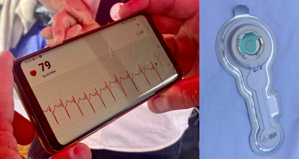 RETT PÅ TELEFONEN: Sensoren viser ekg-signalene rett på telefonen din, via en app. Foto: Siri Gulliksen Tømmerbakke