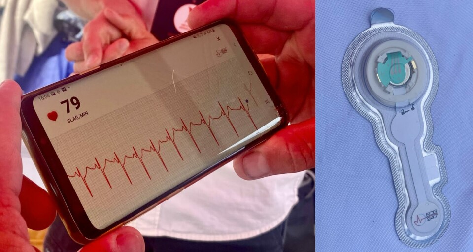 RETT PÅ TELEFONEN: Sensoren viser ekg-signalene rett på telefonen din, via en app. Foto: Siri Gulliksen Tømmerbakke RETT PÅ TELEFONEN: Sensoren viser ekg-signalene rett på telefonen din, via en app. Foto: Siri Gulliksen Tømmerbakke