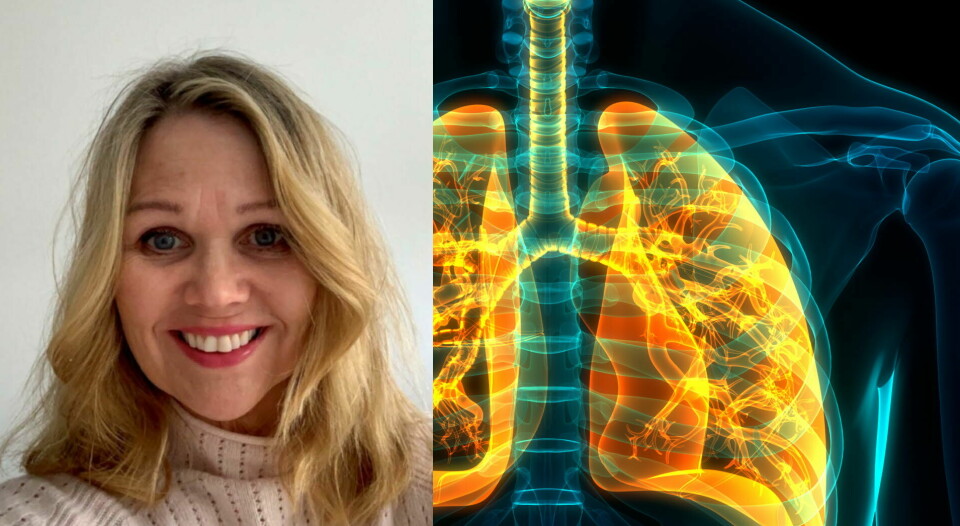 – På verdensbasis er det under ti prosent av pasienter som kan ha nytte av lungerehabilitering, som får det. Det er også et fåtall i Norge, sier Bente Frisk, medlem i Nasjonalt kolsråd. Foto: Privat/Getty Images