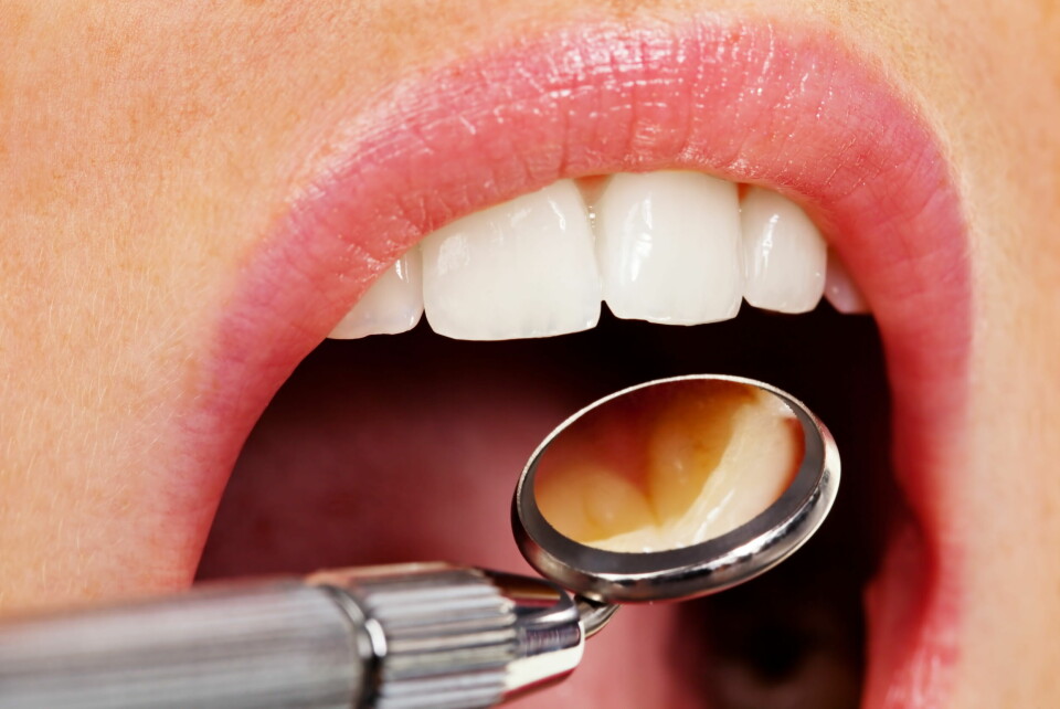 Illustrasjonsfoto: Ifølge WHO har nesten halve verden dårlig tann- og munnhelse.  Foto: Erwin Wodicka