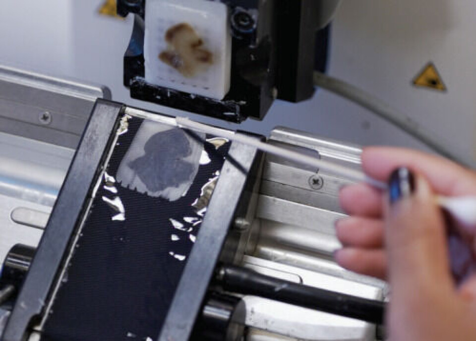 PÅ GLASS: Biopsiene prepareres på små glass-slides, som så scannes inn digitalt, for å kjøres gjennom maskinlæringsalgoritmen.
Foto: Håvard Danielsen PÅ GLASS: Biopsiene prepareres på små glass-slides, som så scannes inn digitalt, for å kjøres gjennom maskinlæringsalgoritmen.
Foto: Håvard Danielsen