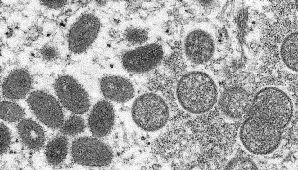ENDRING: Et mikroskopbilde fra amerikanske Centers for Disease Control and Prevention fra et utbrudd av apekopper i 2003. Nå vil FHI endre sykdomsnavnet. Foto: AP