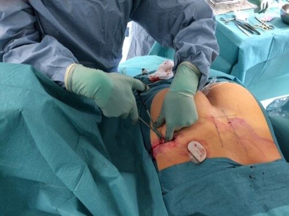 Pacemaker hindrer avføringslekkasje