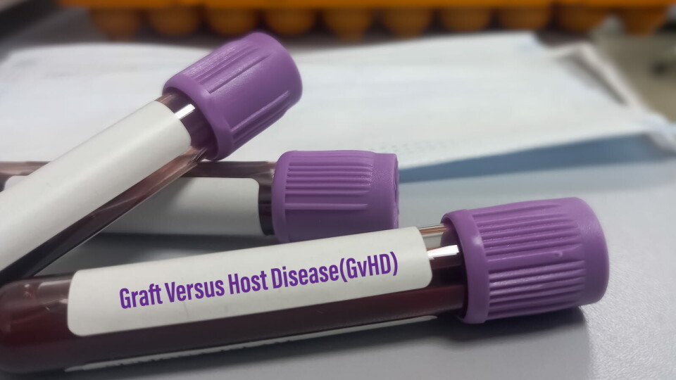 KAN VÆRE ALVORLIG: Sykdommen, på engelsk kalt chronic graft-versus-host disease (cGVHD), er en potensielt livstruende komplikasjon som kan skje etter stamcelle- eller benmargstransplantasjon. Nå har pasientpopulasjonen fått et nytt godkjent legemiddel mot tilstanden. Illustrasjonsbilde: Getty Images Foto:
