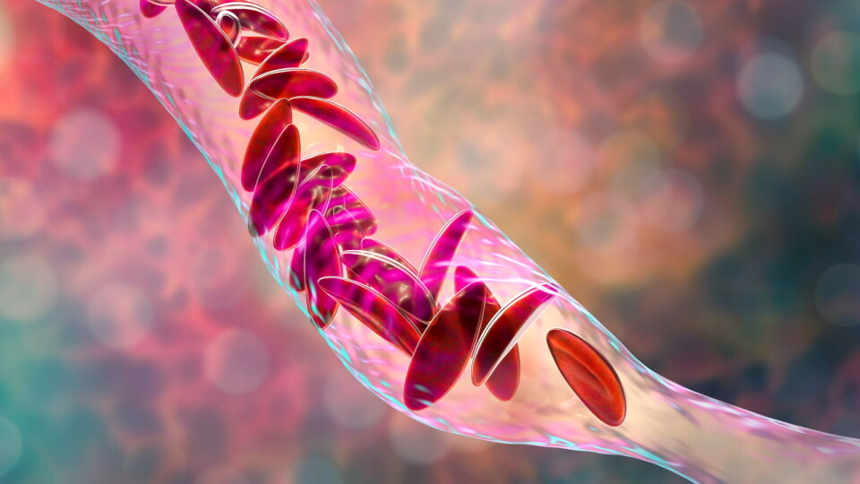 UMØTT BEHOV: – Vi er henrykte over å få støtte fra Bill & Melinda Gates Foundation for å adressere dette globale umøtte medisinske behovet, sier hematolog og direktør for Novartis Institutes for BioMedical Research (NIBR), Jay Bradner. Foto: