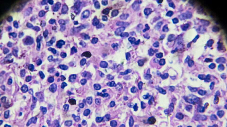 POSITIVE RESULTATER: Copanlisib er ifølge Bayer den første og eneste P13K-hemmeren som har demonstrert bred og overlegen effekt i kombinasjon med rituksimab i pasienter med relapsert iNHL, sammenlignet med placebo og rituksimab. Illustrasjon: Getty Images Foto: