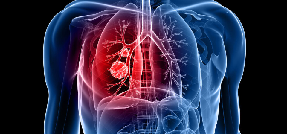 Foto: Thinkstock