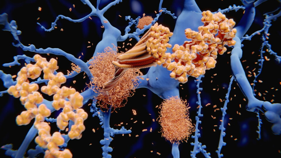 VIRKNINGSMEKANISME: Det monoklonale antistoffet adacanumab fester seg til en substans som kalles amyloid beta. Denne substansen skaper plakk i hjernen til personer med Alzheimers sykdom. Ved å feste seg til amyloid beta, har det vært forventet at medisinen skal kunne hjelpe med å fjerne plakk fra hjernen og forsinke sykdomsutviklingen. Illustrasjonsbilde: Getty Images Foto: