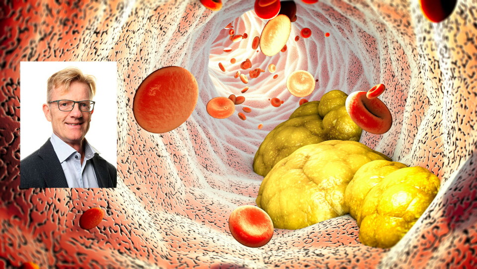 FORSKJELLER: Professor og overlege Kjetil Retterstøl påpeker at de to andre eksisterende PCSK9-hemmerne kan tas selv hjemme med en engangs injeksjonspenn i for eksempel låret. Inklisiran skal settes av helsepersonell to ganger i året. Foto i montasje: UiO/Getty Images Foto: