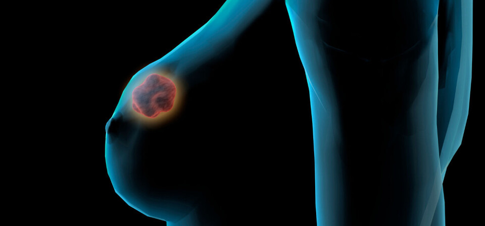 Foto: Thinkstock