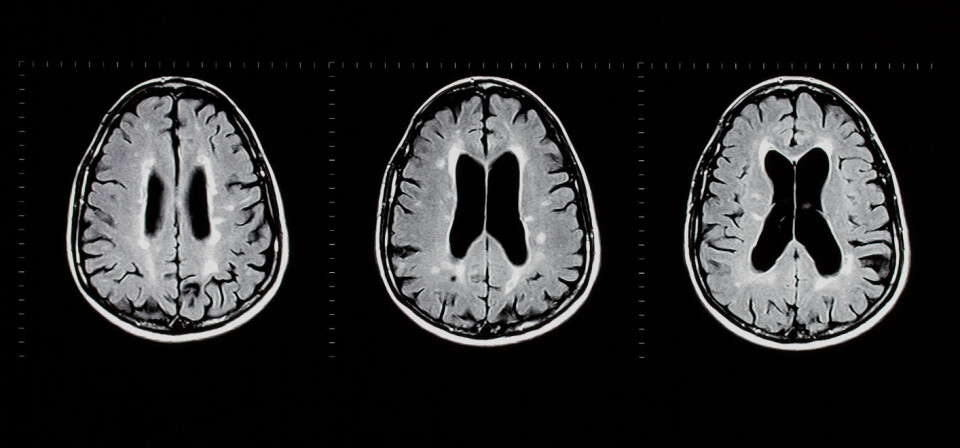 Foto: Thinkstock