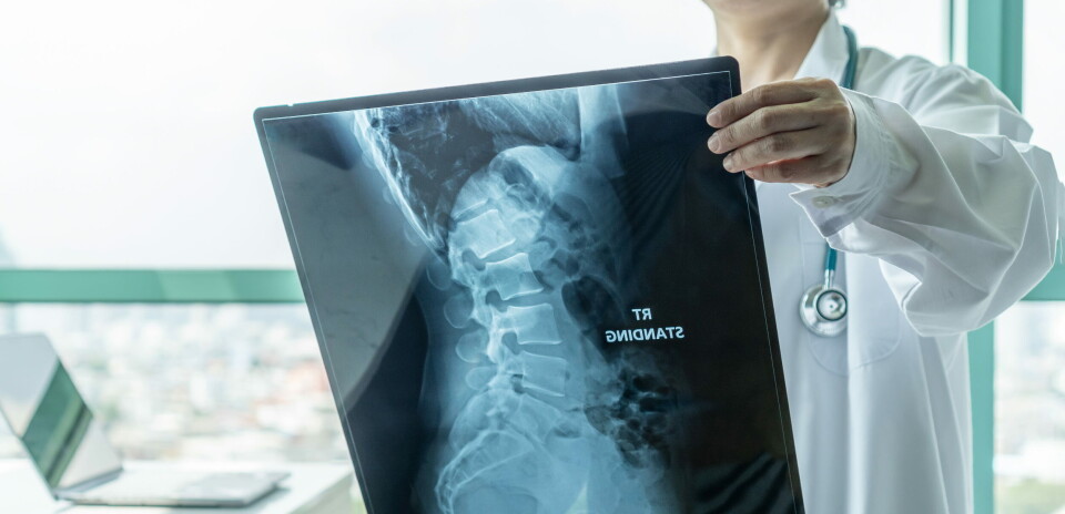 FIRST IN CLASS: Risdiplam blir med mandagens FDA-godkjenning det første SMA-legemidlet som kan administreres oralt hjemmefra. Illustrasjon: Getty Images Foto: