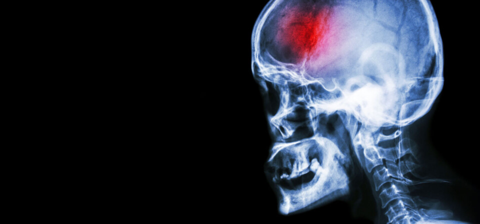 Foto: Thinkstock
