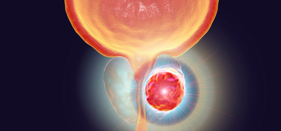 Foto: iStock/Getty Images
