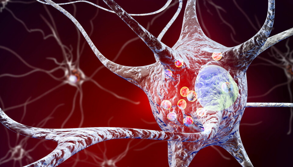 STAMCELLETERAPI: Parkinsons skyldes en gradvis ødeleggelse av nerveceller som skiller ut stoffet dopamin. Forskere har utviklet et stamcelle-produkt som etter transplantasjon, skal modnes til funksjonelle nerveceller som produserer dopamin. Illustrasjonsfoto: Getty Images