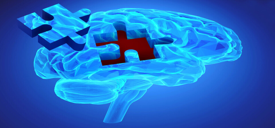 Biogen sier at de ikke tror nederlaget hos konkurrenten motbeviser hele teorien om det amyloide plakket. Foto: Thinkstock