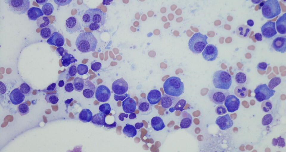 – NY BEHANDLINGSSTANDARD: – Godkjenningen fra Europakommisjonen gir et viktig og nytt terapivalg, og kan være med på å sette en ny behandlingsstandard for myelomatose-pasienter i Europa, sier John Reed, Sanofis globale sjef for forskning og utvikling. Illustrasjon: Getty Images Foto: