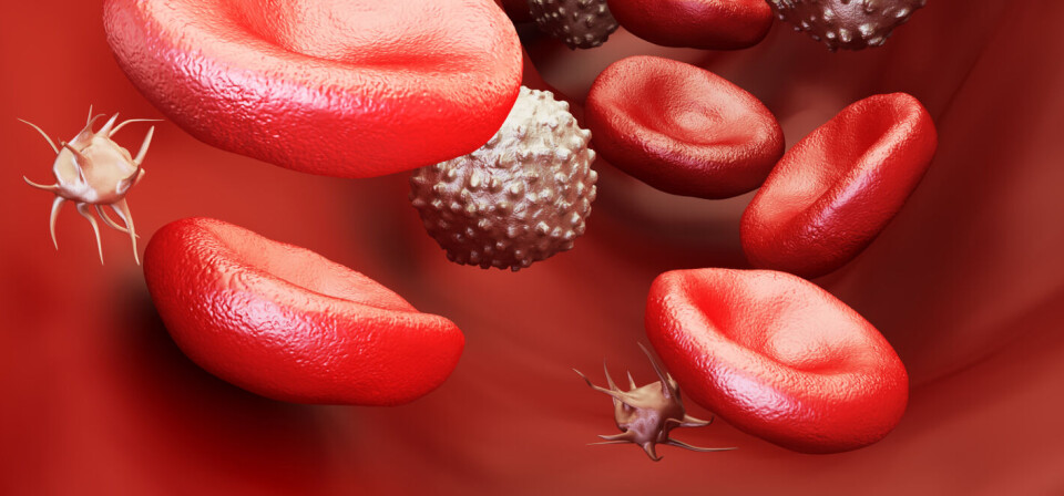 Foto: iStock/Getty Images