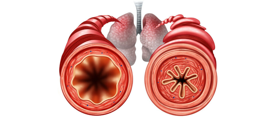 Foto: iStock/Getty Images