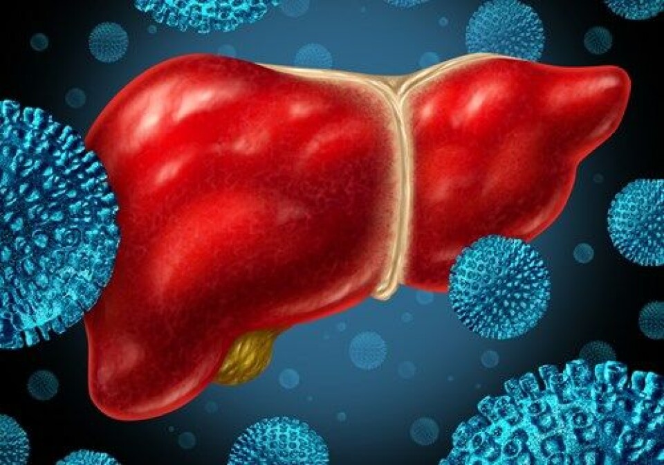 BEDRE BEHANDLING: Pasienter med hepatitt C har fått tilgang til en mer effektiv behandling etter at de direktevirkende legemidlene kom på markedet, men regningen har vært høy.
Foto: Thinkstock