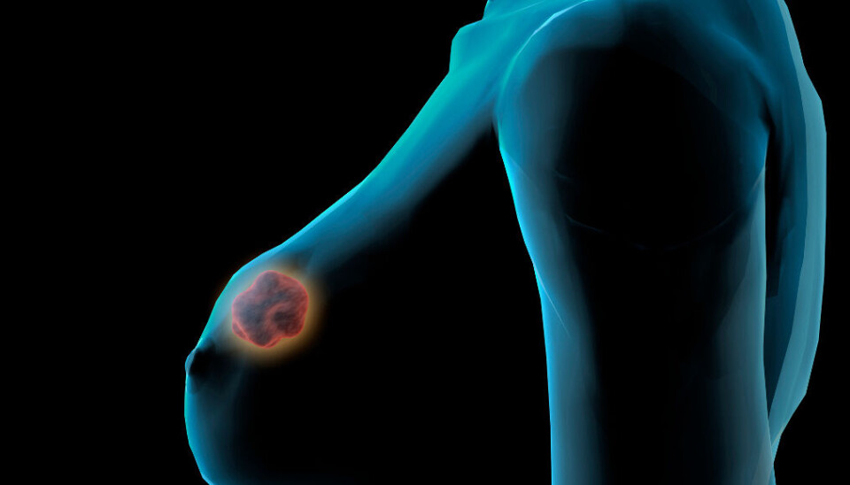 RAPPORT: Rapporten Cancer in Norway 2022 blir publisert klokka 10 onsdag. Den viser blant annet en økning i brystkreft, og nedgang i lungeft i 2022. RAPPORT: Rapporten Cancer in Norway 2022 blir publisert klokka 10 onsdag. Den viser blant annet en økning i brystkreft, og nedgang i lungeft i 2022.