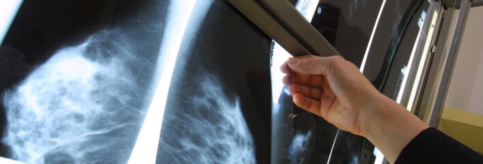 HALV MILLIARD: De beregnede kostnadene per screeningrunde er 574 millioner kroner, ifølge Forskningsrådets evaluering av mammografiprogrammet. Foto: Colourbox HALV MILLIARD: De beregnede kostnadene per screeningrunde er 574 millioner kroner, ifølge Forskningsrådets evaluering av mammografiprogrammet. Foto: Colourbox