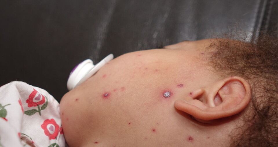 Årsaken til at helsepersonell anbefales å ta vaksinen er først og fremst for å beskytte sårbare pasienter mot alvorlig sykdom og død ved å hindre smitte fra seg selv. I Sverige ble nylig 63 nyfødte utsatt for smitterisiko fra en smittet ansatt ved et sykehus. Illustrasjonsfoto: Colourbox Foto:
