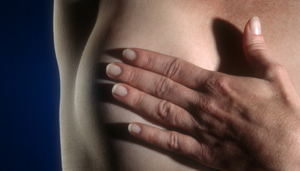 OVERLEVER: Ni av ti som får diagnosen brystkreft overlever i dag sykdommen.