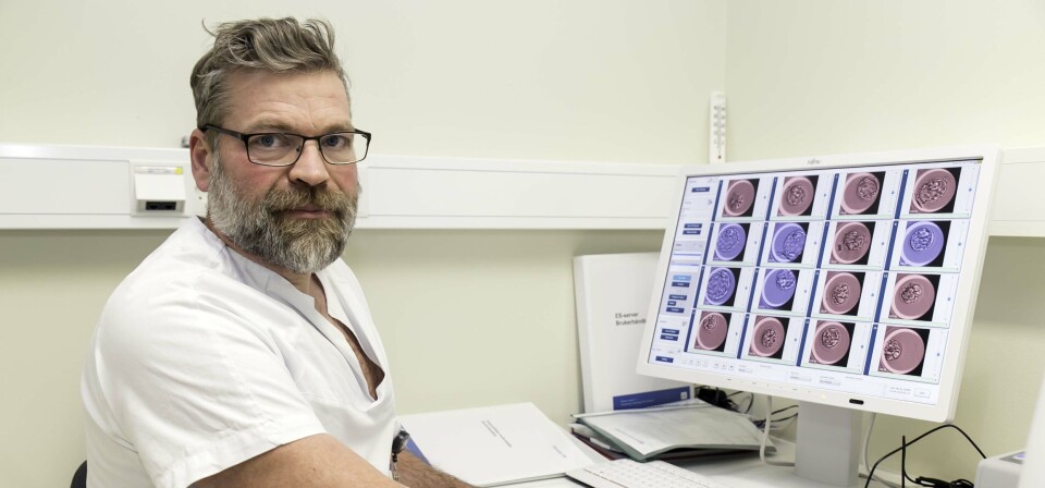 FOR LAV ALDERSGRENSE: Konstituert seksjonsoverlege Øyvind Nytun ved St. Olavs hospital sier at en aldersgrense på 38 år ved fertilitetsbehandling er for lavt, medisinsk sett. Både Oslo universitetssykehus og Sykehuset Telemark har aldersgrense på 38 år. Foto: Unni Skoglund