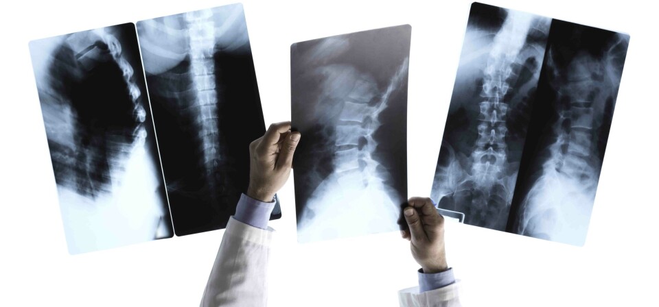 JOBB: Alle kandidatene har nå fått en arbeidsavtale på egen arbeidsplass der de skal beskrive skjelettrøntgenundersøkelser. Foto: Gettyimages