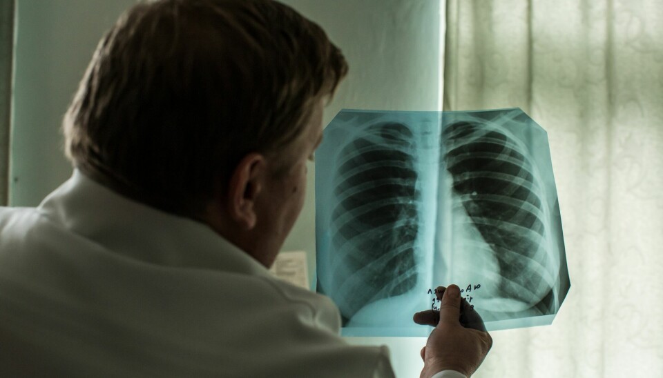 ILLUSTRASJONSBILDE: Dette bildet er av en av Leger Uten Grensers røntgenlaboratorieassistenter, som holder opp et røntgenbilde av en pasients lunger ved behandlingssenteret for legemiddelresistent tuberkulose (DR-TB) i Zhytomyr Oblast i Ukraina i oktober 2018.