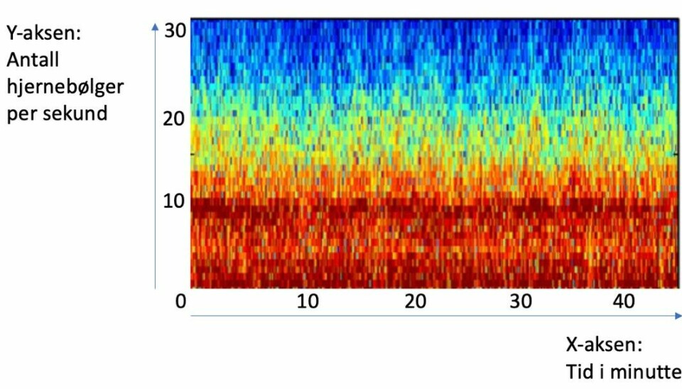 RIKTIG NARKOSEDYBDE: Fargemønster med to langsgående røde striper angir hjernebølger med fart på 1 og 10 per sekund. Disse har stor og rød bølgekraft, forklarer overlege Rimstad.