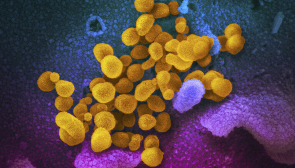 VIRUS: Et bilde av koronavirus tatt med elektronmikroskop. Foto: AP / NTB