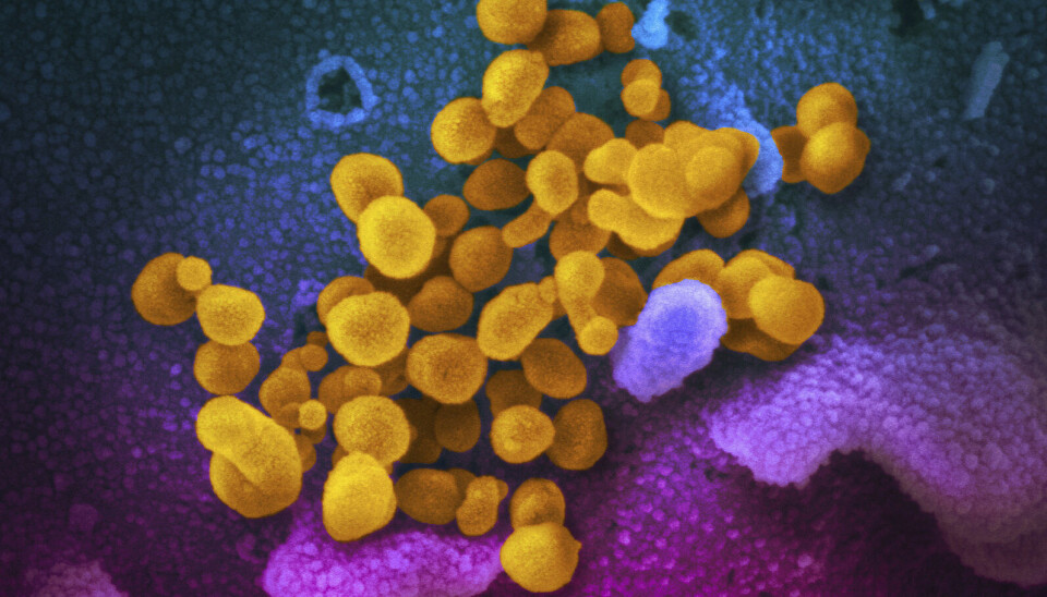 VIRUS: Et bilde av koronavirus tatt med elektronmikroskop. Foto: AP / NTB VIRUS: Et bilde av koronavirus tatt med elektronmikroskop. Foto: AP / NTB