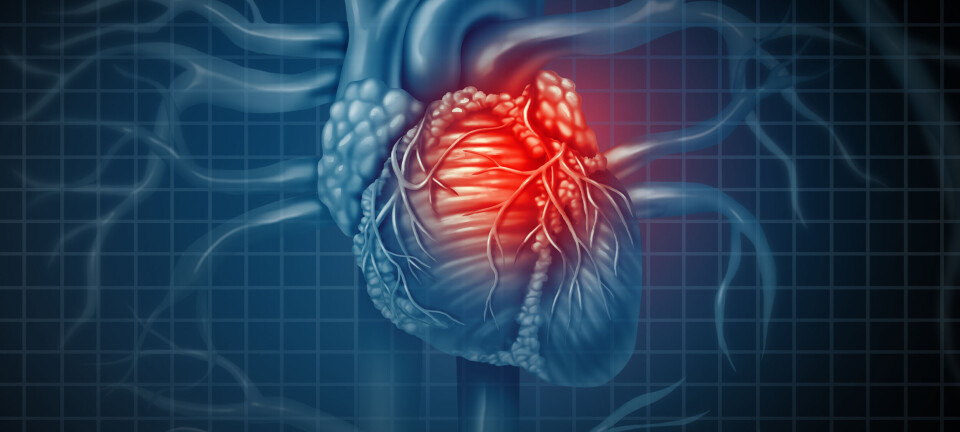 Dystert for hjertehelsen til voksne og eldre med psykisk utviklingshemning