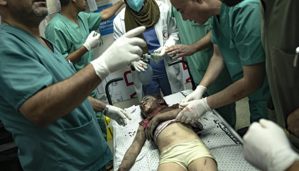 FARLIG: Leger og andre helsearbeidere jobber døgnet rundt for å behandle sårede etter de israelske angrepene på Gazastripen. Denne lille jenta ble såret i et angrep mot Khan Younis mandag. Foto: AP / NTB