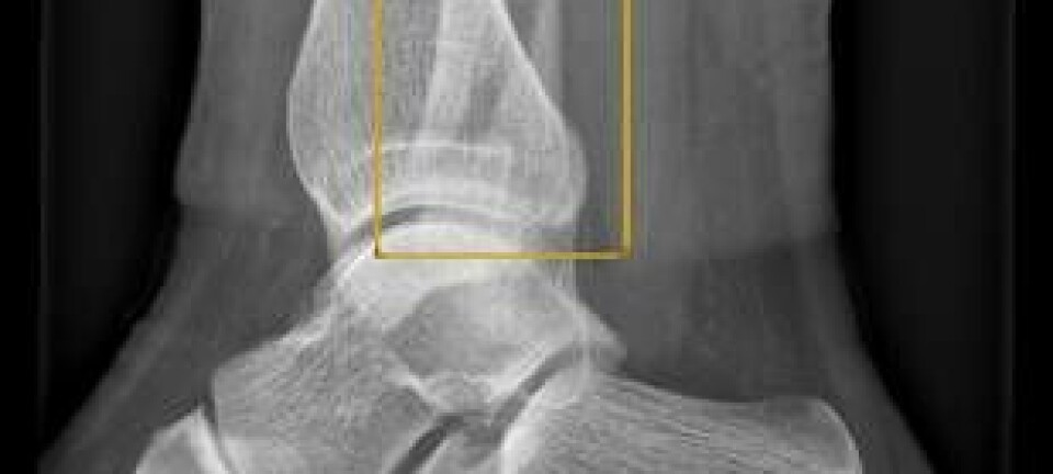 LIS-leger ved skadelegevakten i Oslo skal få KI-støtte på kveldsvakt