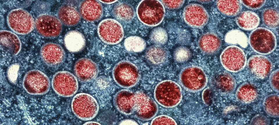 Den svenske regjeringen kaller inn krisegruppe etter mpox-tilfelle