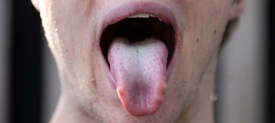 Forskning: KI-analyse av tungebilder kan si om du er syk