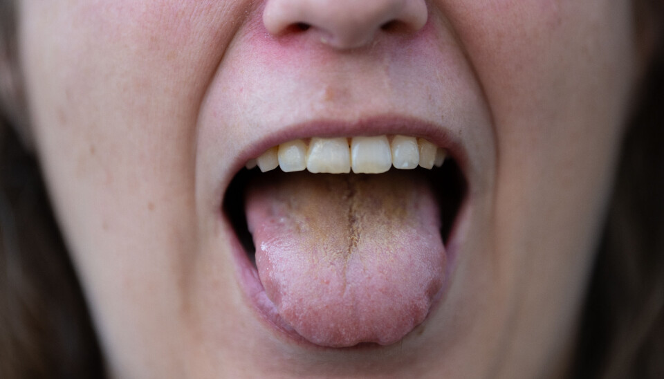 MANGLER VITENSKAPELIG STØTTE: Tradisjonell kinesisk medisin har lenge vært en omstridt praksis innen vestlig medisin, hvor mange av dens metoder, som akupunktur og tungediagnostikk, mangler vitenskapelig støtte, skriver Damoun Nassehi. Foto: Martin Solhaug Standal / NTB